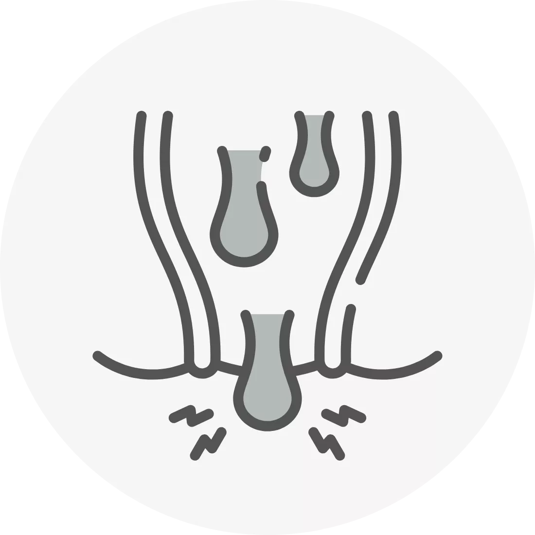 新竹竹北 台中北屯 青心診所 痔瘡微創手術 痔瘡消融手術示意圖