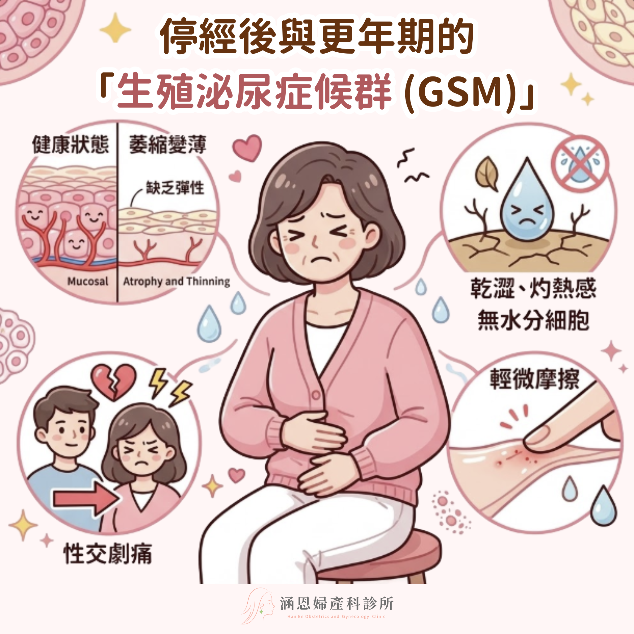 更年期生殖泌尿症候群GSM雌激素缺乏導致陰道黏膜萎縮與乾澀破皮