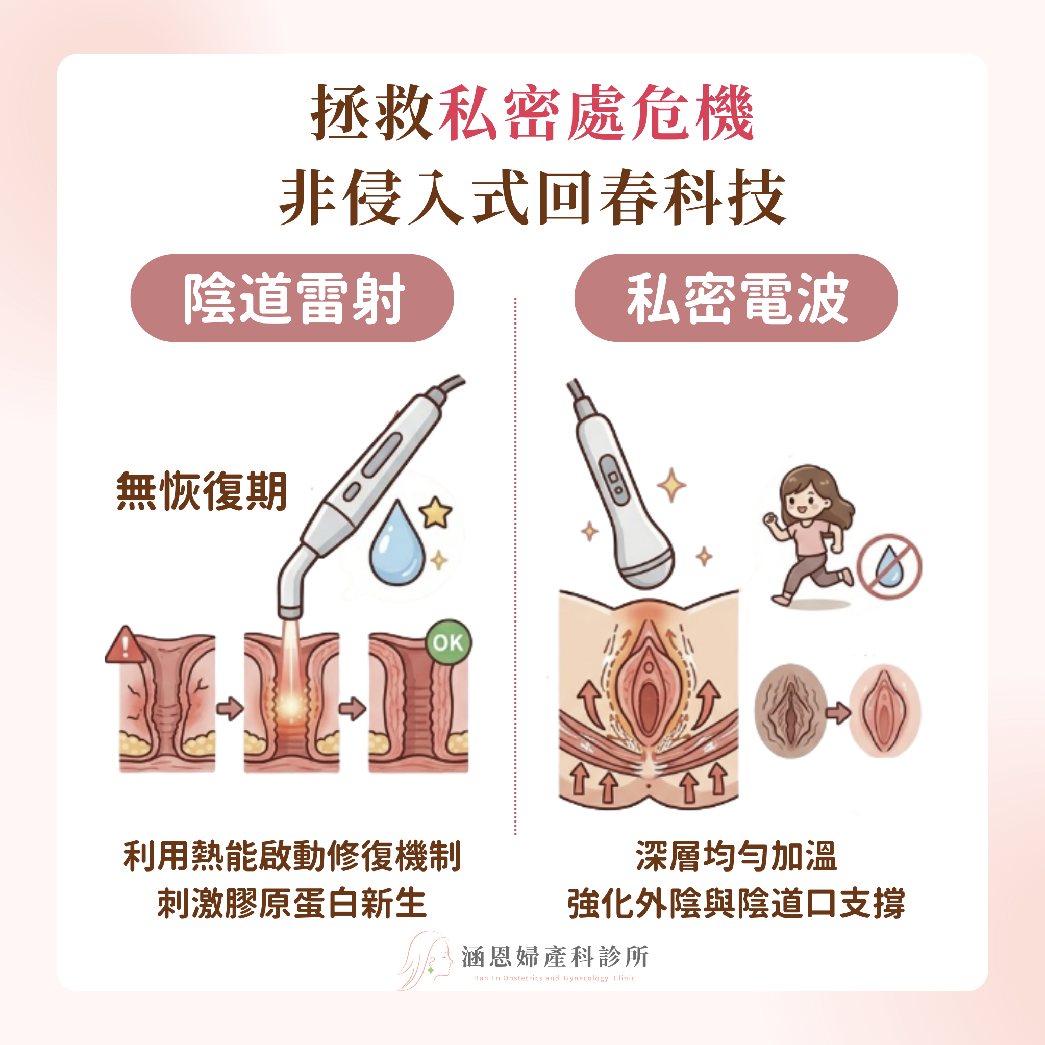 拯救私密處危機陰道雷射與高階能量儀器治療改善乾澀與輕度漏尿