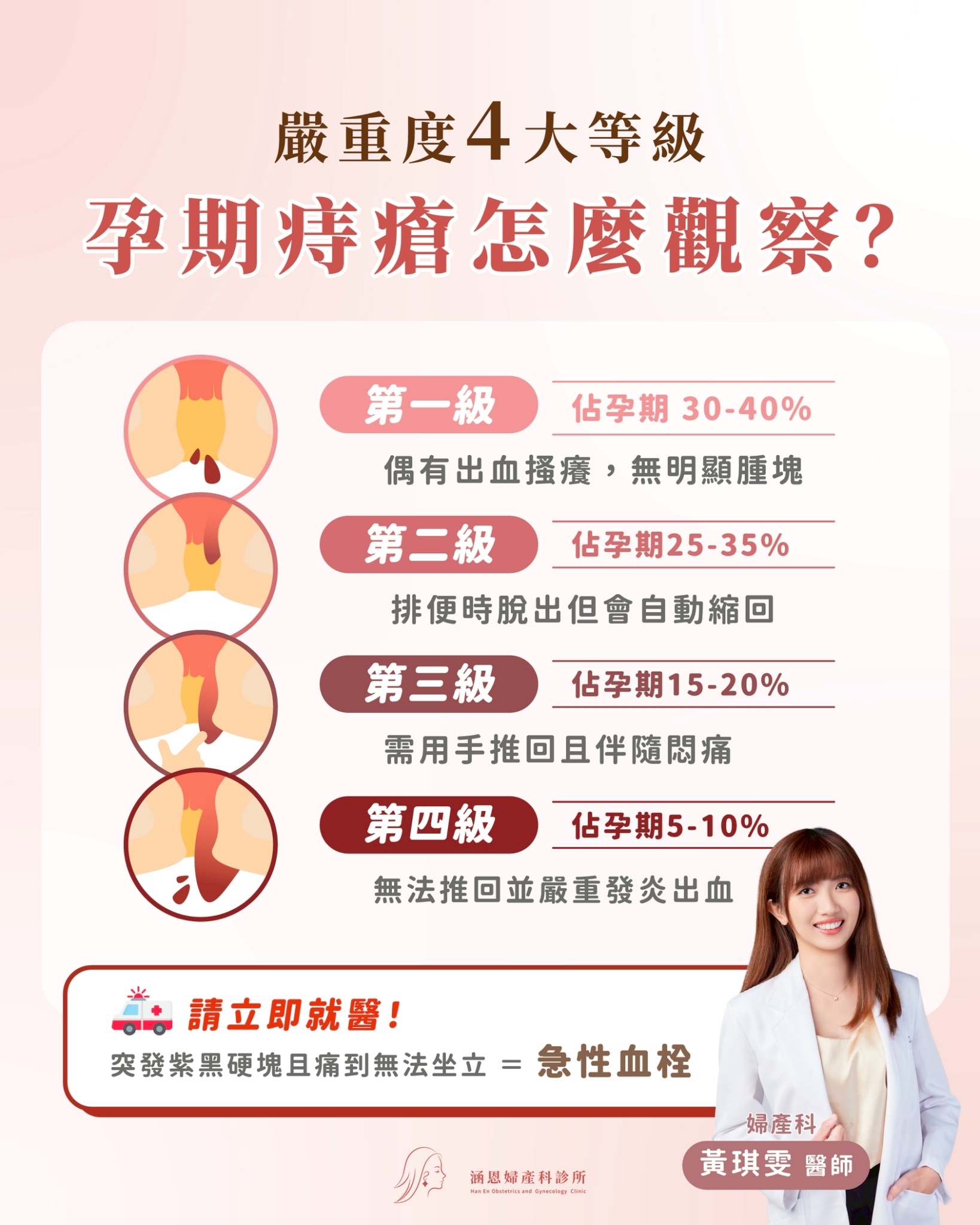 懷孕痔瘡4級嚴重度分級對照表